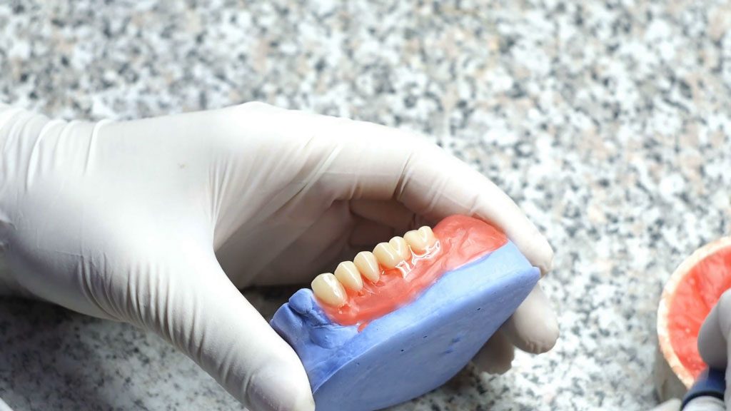 Làm hàm răng giả
